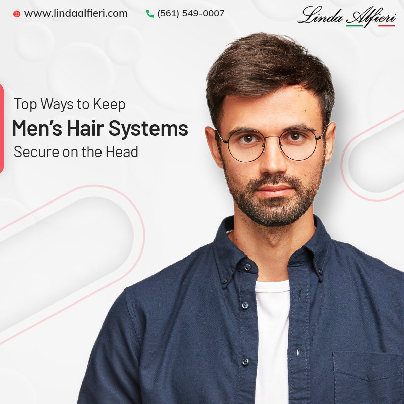 Hair replacement for men