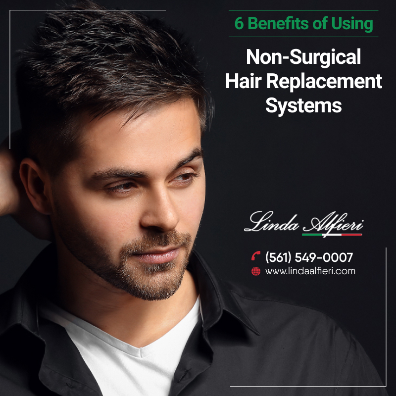 What Are the Benefits of Using Non-Surgical Hair Replacement Systems?