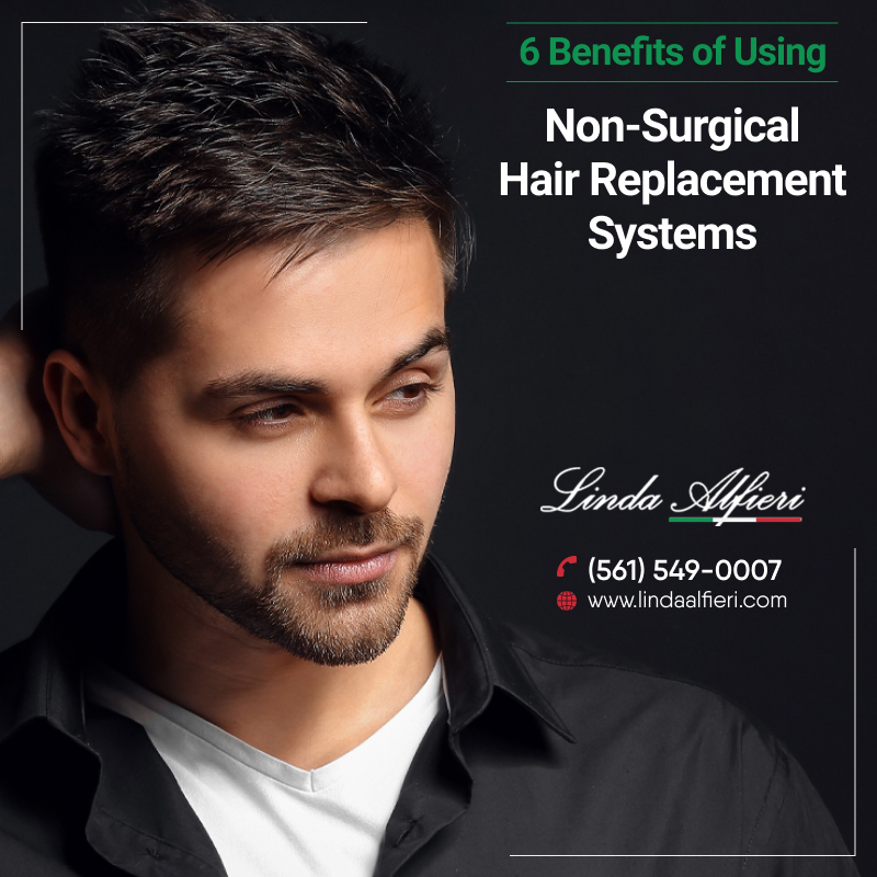 Hair Replacement Services Palm Beach Florida