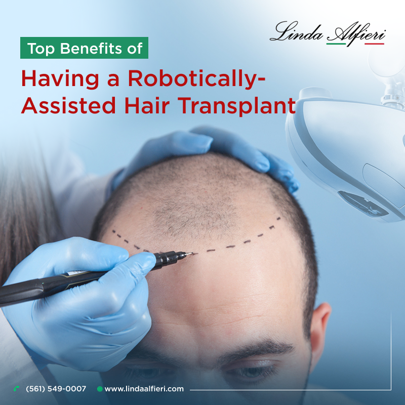 Hair Transplant in Boca Raton