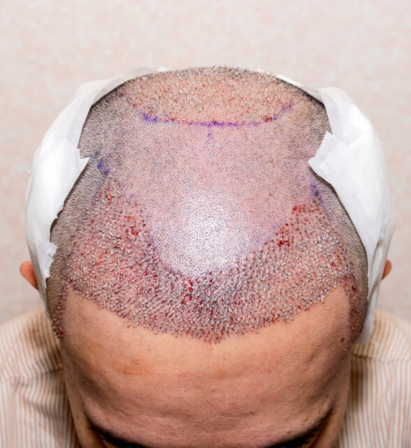 Safety Hand Pieces and Punches Image