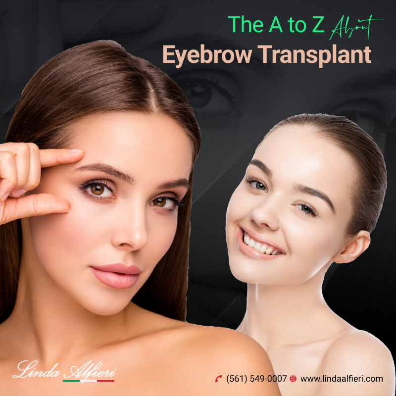 eyebrow transplant in Boca Raton