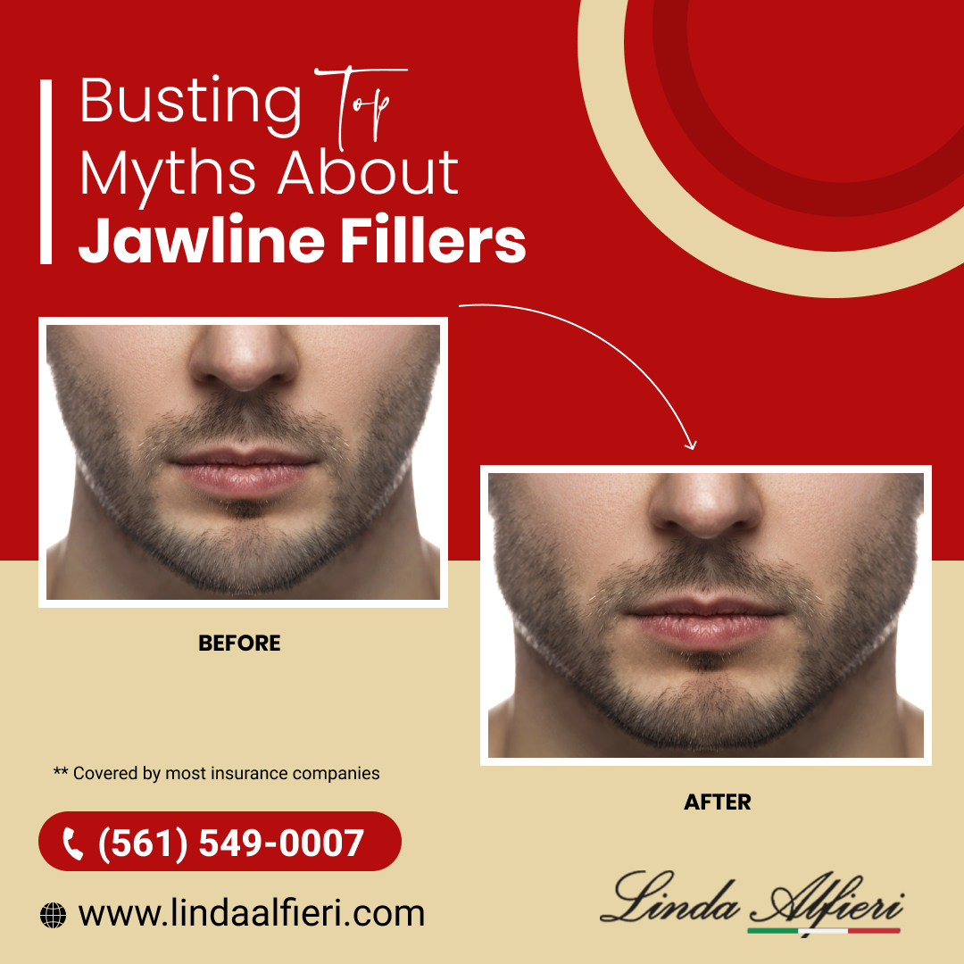 Jawline fillers for men in Boca Raton