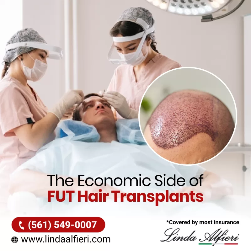 Hair Transplant In Boca Raton