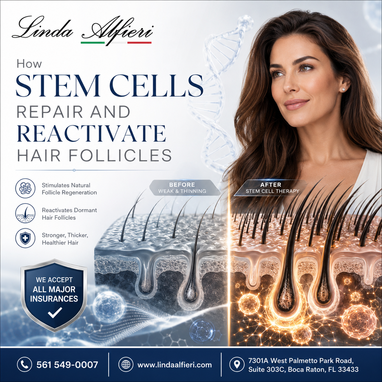 Stem Cell Hair Boca Raton
